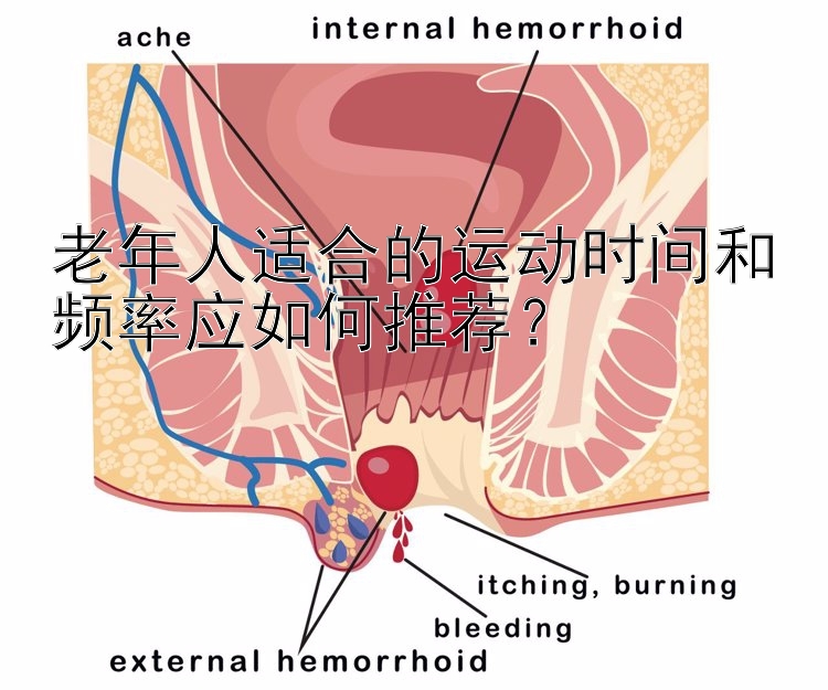 老年人适合的运动时间和频率应如何推荐？