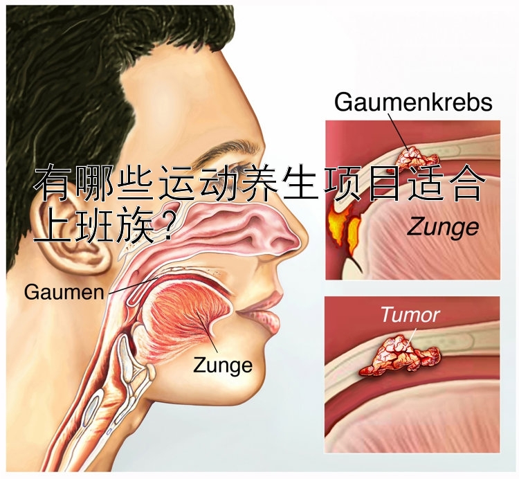 有哪些运动养生项目适合上班族？