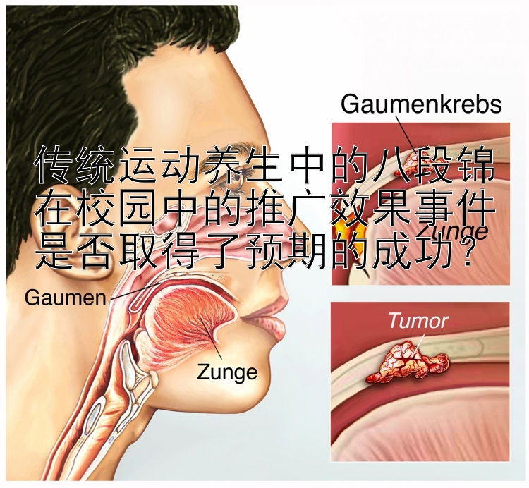 传统运动养生中的八段锦在校园中的推广效果事件是否取得了预期的成功？