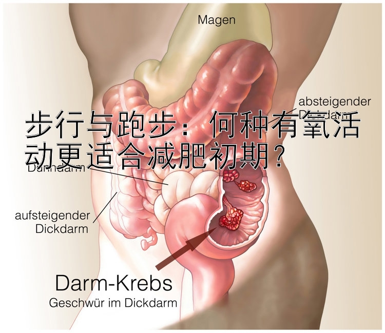 步行与跑步：何种有氧活动更适合减肥初期？