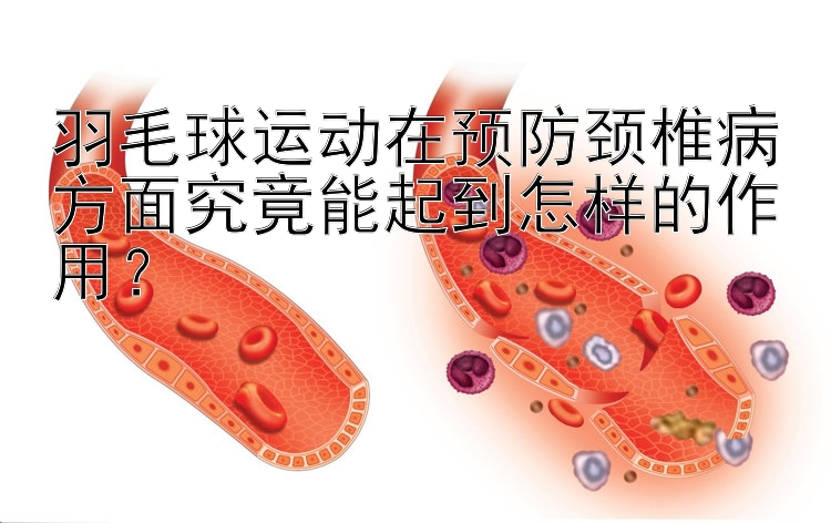 羽毛球运动在预防颈椎病方面究竟能起到怎样的作用？